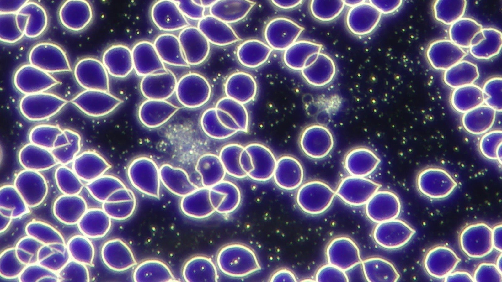 Imagen de microscopía darkfield de células sanguíneas vivas, sin procesar